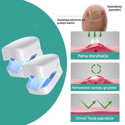 Zdrowa Stopa™ Laserowa Regeneracja Paznokci